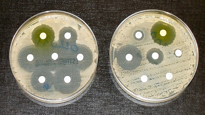 image of cells in a culture antibiotic drug development research via Unsplash