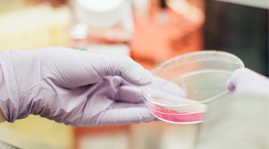 researcher scientist holding a lab petri dish
