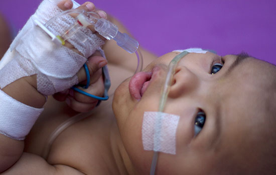 infant in intensive care with RSV
