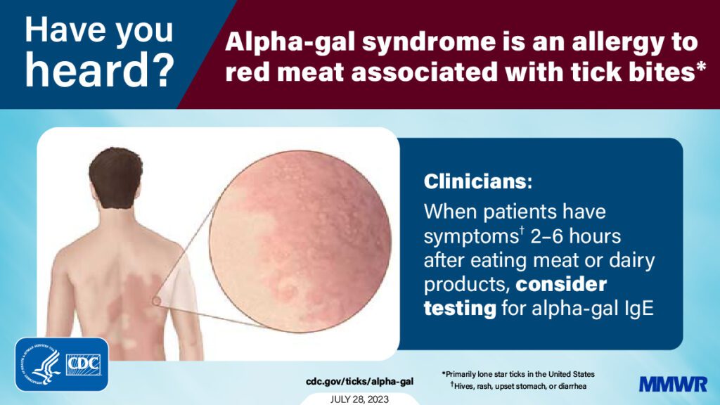 CDC What is alpha-gal syndrome?