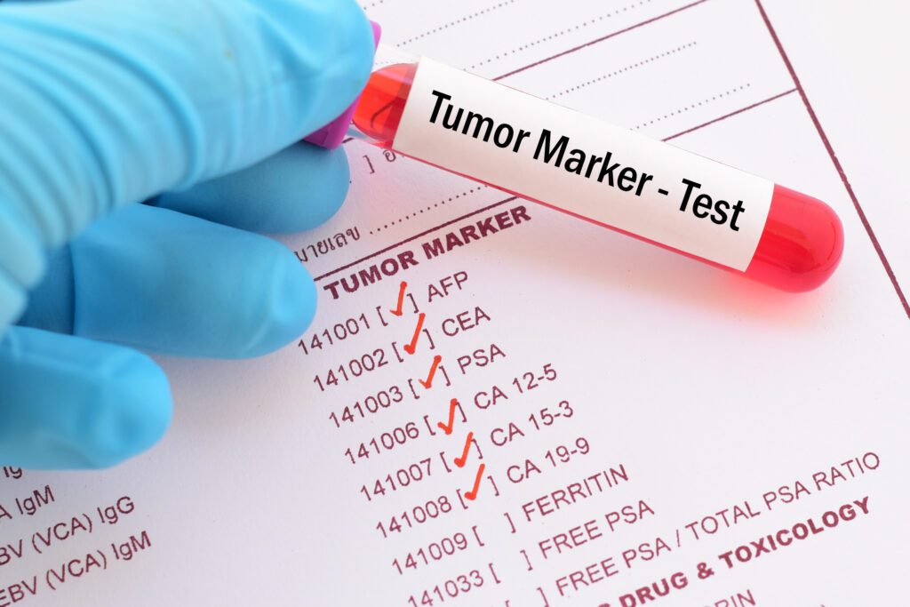 Test for tumor biomarkers