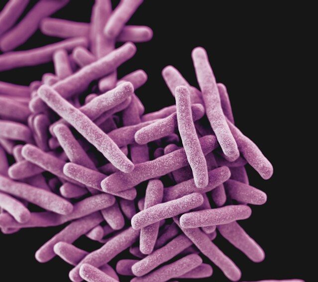 antimicrobial resistant pathogen